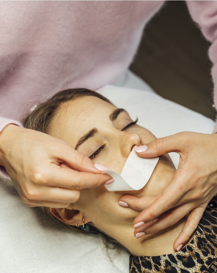 Ontharing - Bovenlip